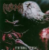 PYAEMIA  - CD CEREBRAL CEREAL