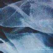  STAINS OF RESIGNATION [VINYL] - supershop.sk