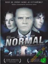  Normal DVD - supershop.sk