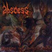 ABSCESS  - VINYL THROUGH THE CR..