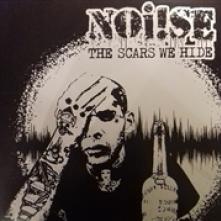 NOISE  - VINYL SCARS WE HIDE [VINYL]
