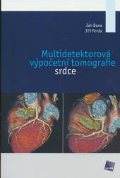 Multidetektorová výpočetní tomografie srdce - supershop.sk